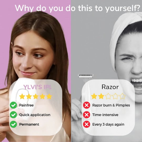 Ylvis IPL szőrtelenítő készülék – Sima, szőrtelen bőr otthon
